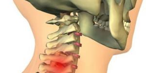 What exercises are recommended for a herniated lumbar spine?